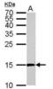 Cytidine deaminase antibody, NBP1-31412, Novus Biologicals, Western Blot image 