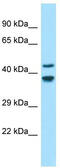 Gliomedin antibody, TA333404, Origene, Western Blot image 