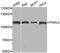 Piwi Like RNA-Mediated Gene Silencing 4 antibody, A3144, ABclonal Technology, Western Blot image 