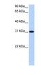 Trinucleotide Repeat Containing 18 antibody, NBP1-91426, Novus Biologicals, Western Blot image 