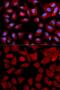 Proteasome 26S Subunit, ATPase 4 antibody, GTX54612, GeneTex, Immunofluorescence image 