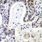 LSM2 Homolog, U6 Small Nuclear RNA And MRNA Degradation Associated antibody, A07586-1, Boster Biological Technology, Immunohistochemistry frozen image 