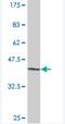 T-Box 18 antibody, H00009096-M08, Novus Biologicals, Western Blot image 