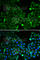 Hypoxia Inducible Factor 1 Subunit Alpha Inhibitor antibody, A5466, ABclonal Technology, Immunofluorescence image 