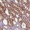 GEN1 Holliday Junction 5' Flap Endonuclease antibody, PA5-54335, Invitrogen Antibodies, Immunohistochemistry paraffin image 