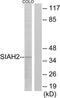 Siah E3 Ubiquitin Protein Ligase 2 antibody, TA314535, Origene, Western Blot image 