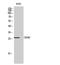 CKLF Like MARVEL Transmembrane Domain Containing 2 antibody, STJ92349, St John