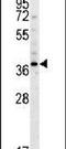 26S proteasome non-ATPase regulatory subunit 7 antibody, PA5-24630, Invitrogen Antibodies, Western Blot image 