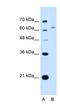 WSC Domain Containing 2 antibody, NBP1-91299, Novus Biologicals, Western Blot image 