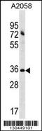 Acyl-CoA Binding Domain Containing 6 antibody, 60-012, ProSci, Western Blot image 