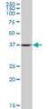 Aldolase, Fructose-Bisphosphate A antibody, H00000226-M03, Novus Biologicals, Western Blot image 