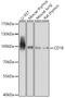 Integrin Subunit Beta 2 antibody, 18-552, ProSci, Western Blot image 