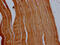 Actinin Alpha 2 antibody, CSB-PA001242LA11HU, Cusabio, Immunohistochemistry paraffin image 