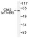 Serine/threonine-protein kinase Chk2 antibody, AP01556PU-N, Origene, Western Blot image 