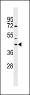 Neuropeptides B And W Receptor 1 antibody, LS-C158416, Lifespan Biosciences, Western Blot image 