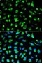 Enoyl-CoA delta isomerase 1, mitochondrial antibody, LS-C331354, Lifespan Biosciences, Immunofluorescence image 