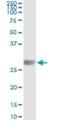 Kirre Like Nephrin Family Adhesion Molecule 2 antibody, H00084063-M01, Novus Biologicals, Immunoprecipitation image 