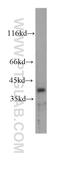 Caudal Type Homeobox 2 antibody, 60243-1-Ig, Proteintech Group, Western Blot image 