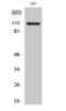 Calcium Voltage-Gated Channel Auxiliary Subunit Alpha2delta 4 antibody, A09975-1, Boster Biological Technology, Western Blot image 