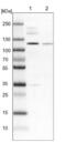 Zinc Finger Protein 598 antibody, NBP1-84659, Novus Biologicals, Western Blot image 