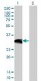 BAF Chromatin Remodeling Complex Subunit BCL11A antibody, H00053335-M03, Novus Biologicals, Western Blot image 