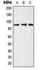 Lysine Acetyltransferase 2A antibody, LS-C353989, Lifespan Biosciences, Western Blot image 