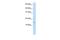 Vesicle Associated Membrane Protein 5 antibody, GTX46407, GeneTex, Western Blot image 