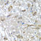 O-Sialoglycoprotein Endopeptidase Like 1 antibody, A14053, Boster Biological Technology, Immunohistochemistry paraffin image 