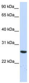 Tetratricopeptide Repeat Domain 33 antibody, TA334451, Origene, Western Blot image 