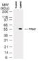 Tryptophan hydroxylase 2 antibody, NB100-61104, Novus Biologicals, Western Blot image 