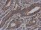 Vezatin, Adherens Junctions Transmembrane Protein antibody, GTX116240, GeneTex, Immunohistochemistry paraffin image 