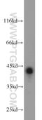 Synaptonemal Complex Central Element Protein 1 antibody, 17406-1-AP, Proteintech Group, Western Blot image 