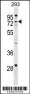 Zinc Finger CCHC-Type Containing 8 antibody, 59-345, ProSci, Western Blot image 