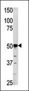 Phosphoglycerate Kinase 2 antibody, 62-701, ProSci, Western Blot image 