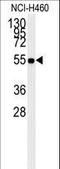 Aldehyde Dehydrogenase 1 Family Member A1 antibody, LS-B10149, Lifespan Biosciences, Western Blot image 