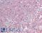 Uncharacterized protein KIAA0802 antibody, LS-B9786, Lifespan Biosciences, Immunohistochemistry paraffin image 