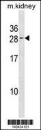 Vacuolar Protein Sorting 25 Homolog antibody, 60-656, ProSci, Western Blot image 
