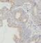 Beta ig-h3 antibody, FNab08641, FineTest, Immunohistochemistry frozen image 