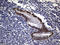 RB Transcriptional Corepressor 1 antibody, LS-C793917, Lifespan Biosciences, Immunohistochemistry paraffin image 
