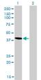 Testin LIM Domain Protein antibody, H00026136-M01, Novus Biologicals, Western Blot image 