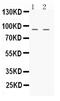 Ubiquitin Like With PHD And Ring Finger Domains 2 antibody, PA5-80206, Invitrogen Antibodies, Western Blot image 