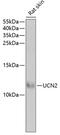 Urocortin 2 antibody, GTX65915, GeneTex, Western Blot image 