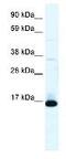 Transcription Factor 21 antibody, ab32981, Abcam, Western Blot image 