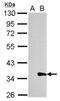 Galectin 8 antibody, NBP2-16585, Novus Biologicals, Western Blot image 