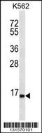 Serine Peptidase Inhibitor, Kazal Type 8 (Putative) antibody, 56-527, ProSci, Western Blot image 