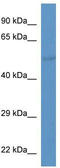 Solute Carrier Family 37 Member 2 antibody, TA334632, Origene, Western Blot image 