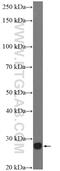 Retinoschisin 1 antibody, 24430-1-AP, Proteintech Group, Western Blot image 