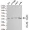 SET And MYND Domain Containing 2 antibody, TA347054, Origene, Western Blot image 