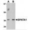 Spermatogenesis Associated 1 antibody, MBS151453, MyBioSource, Western Blot image 
