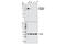Androgen Receptor antibody, 5153T, Cell Signaling Technology, Western Blot image 